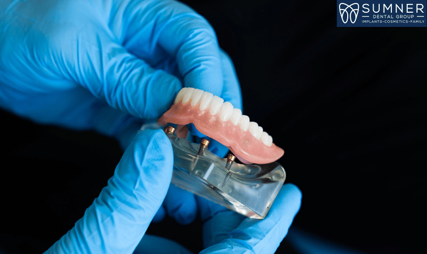 Dentures in Gallatin